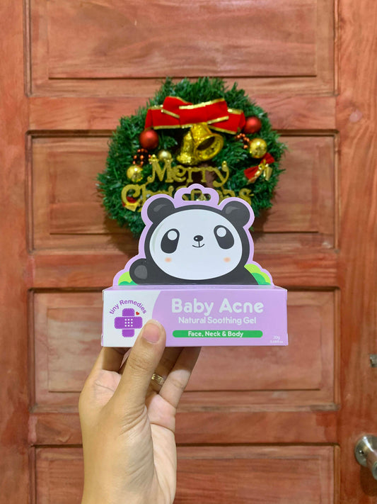 Tiny Buds Baby Acne Soothing Gel 20g