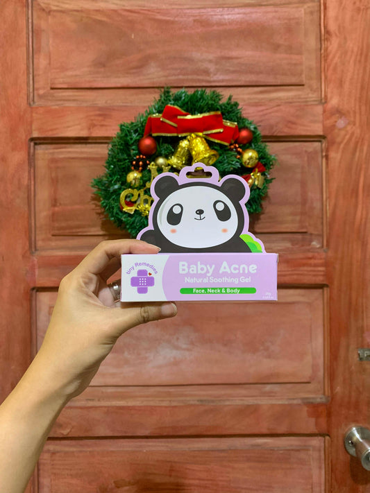 Tiny Buds Baby Acne Natural Soothing Gel 20g